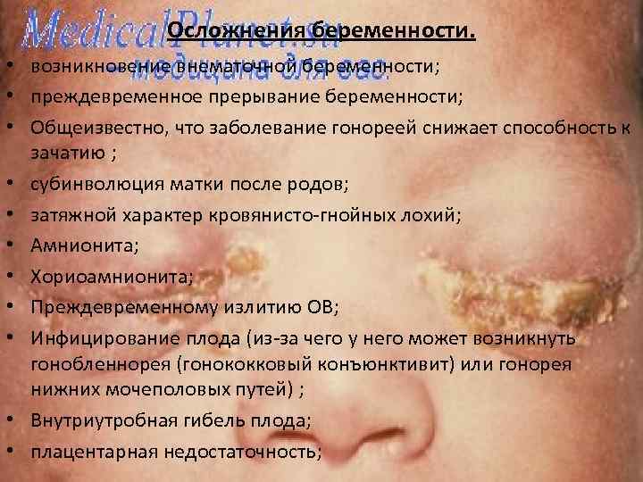 Осложнения беременности. • возникновение внематочной беременности; • преждевременное прерывание беременности; • Общеизвестно, что заболевание