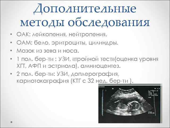 Дополнительные методы обследования ОАК: лейкопения, нейтропения. ОАМ: бело, эритроциты, цилиндры. Мазок из зева и