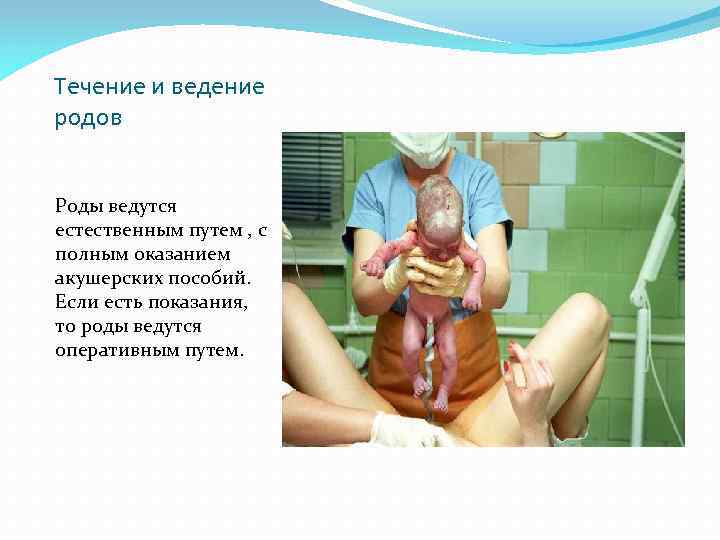 Течение и ведение родов Роды ведутся естественным путем , с полным оказанием акушерских пособий.