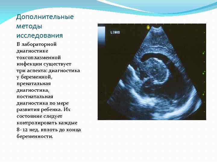 Дополнительные методы исследования В лабораторной диагностике токсоплазменной инфекции существует три аспекта: диагностика у беременной,