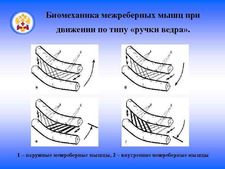 Биомеханика межреберных мышц при движении по типу «ручки ведра» . 1 – наружные межреберные