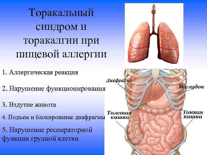 Торакальный синдром и торакалгии при пищевой аллергии 1. Аллергическая реакция 2. Нарушение функционирования 3.