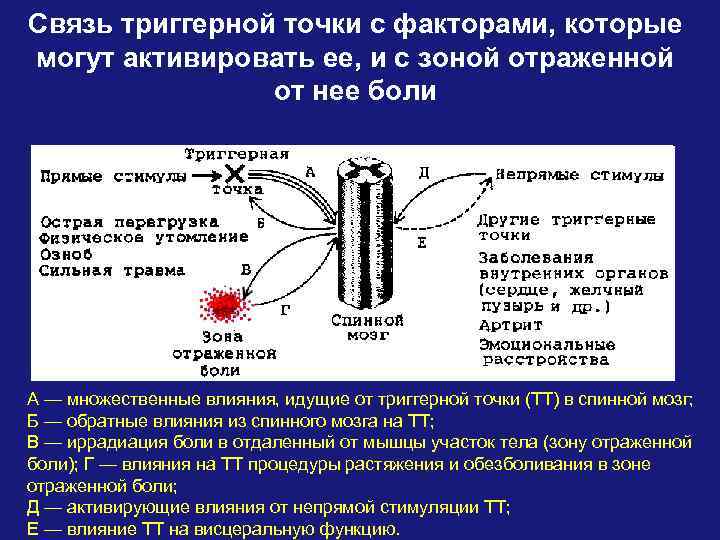 Связь триггерной точки с факторами, которые могут активировать ее, и с зоной отраженной от