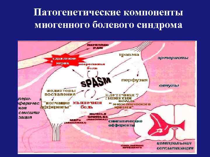 Патогенетические компоненты миогенного болевого синдрома 