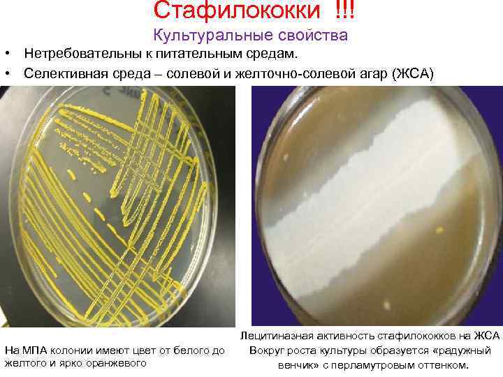 Стафилококки !!! Культуральные свойства • Нетребовательны к питательным средам. • Селективная среда –