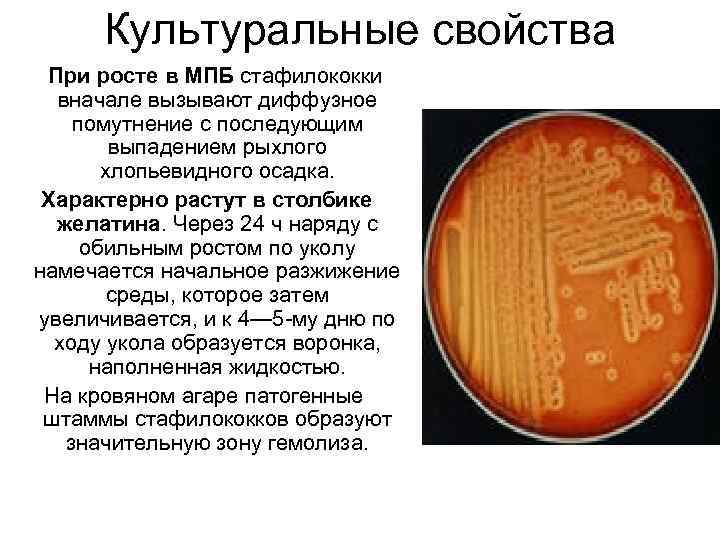 Культуральные свойства При росте в МПБ стафилококки вначале вызывают диффузное помутнение с последующим выпадением