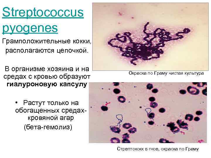 Streptococcus pyogenes Грамположительные кокки, располагаются цепочкой. В организме хозяина и на средах с кровью