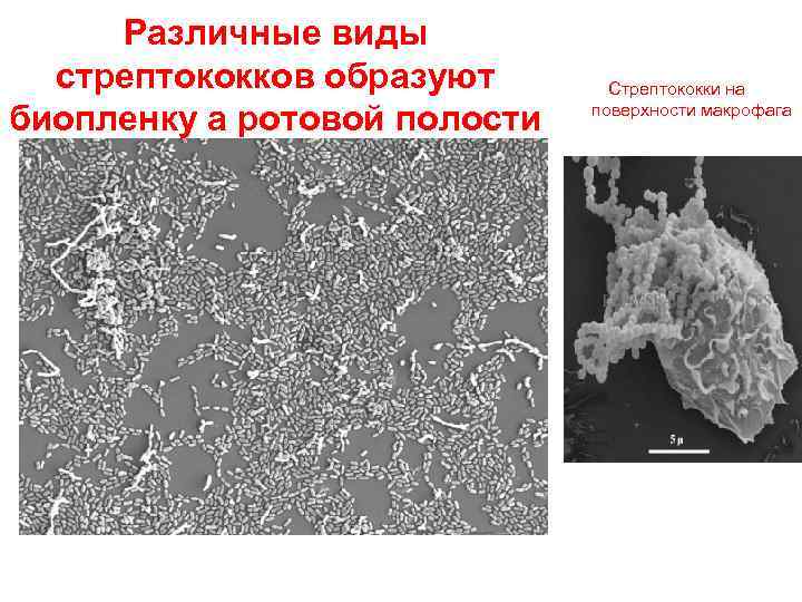 Различные виды стрептококков образуют биопленку а ротовой полости Стрептококки на поверхности макрофага 
