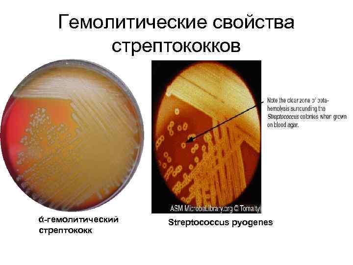 Гемолитические свойства стрептококков ά-гемолитический стрептококк Streptococcus pyogenes 