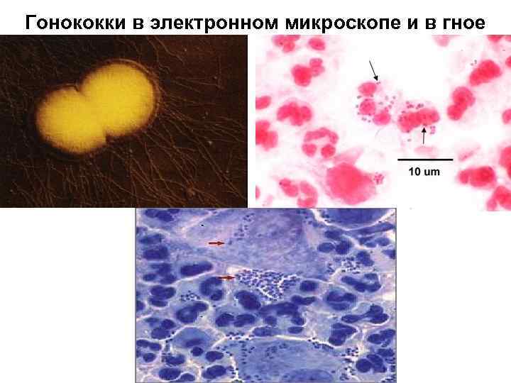 Экспресс Тест На Гонококк Купить