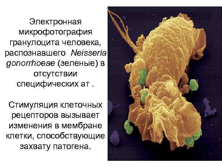 Электронная микрофотография гранулоцита человека, распознавшего Neisseria gonorrhoeae (зеленые) в отсутствии специфических ат. Стимуляция клеточных