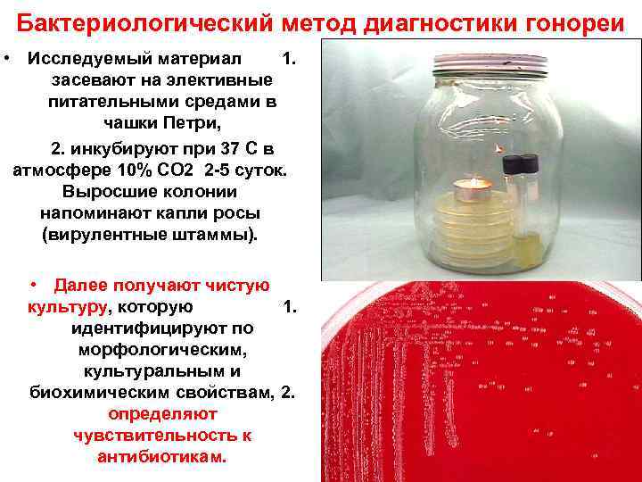 Бактериологический метод диагностики гонореи • Исследуемый материал 1. засевают на элективные питательными средами в