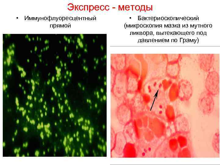 Экспресс - методы • Иммунофлуоресцентный прямой • Бактериоскопический (микроскопия мазка из мутного ликвора, вытекающего