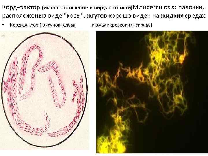 Корд-фактор (имеет отношение к вирулентности)M. tuberculosis: палочки, расположеныв виде "косы", жгутов хорошо виден на