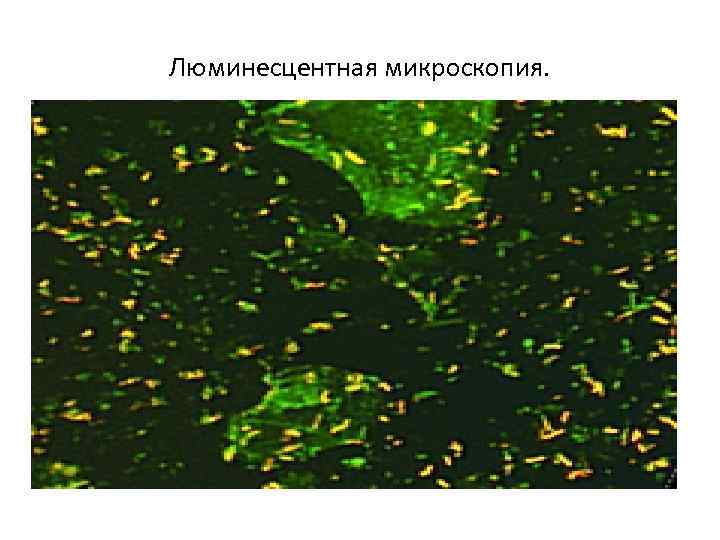 Люминесцентная микроскопия. 