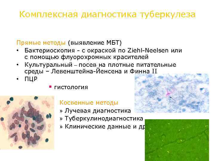 Комплексная диагностика туберкулеза Прямые методы (выявление МБТ) • Бактериоскопия - с окраской по Ziehl-Neelsen