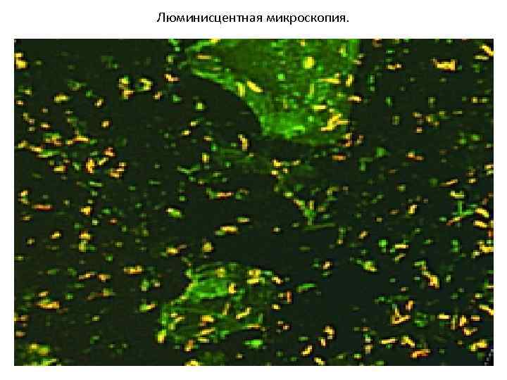 Люминисцентная микроскопия. 