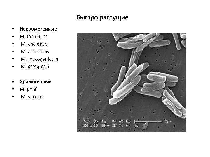 Быстро растущие • • • Нехромогенные M. fortuitum M. chelonae M. abscessus M. mucogenicum