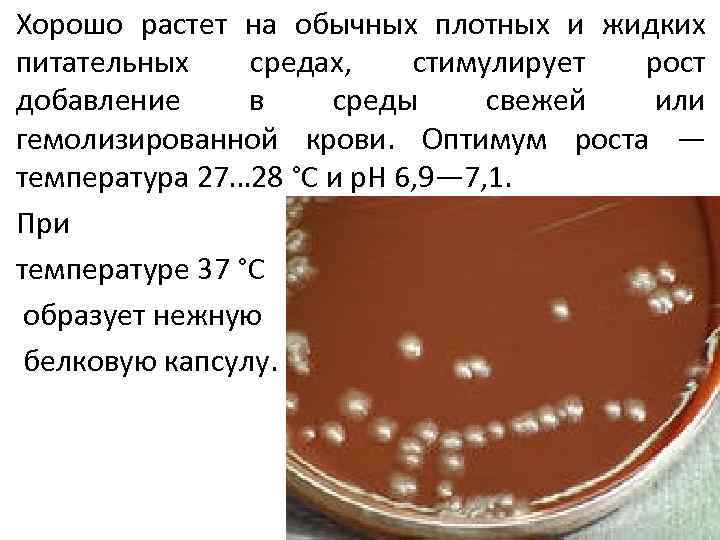 Хорошо растет на обычных плотных и жидких питательных средах, стимулирует рост добавление в среды