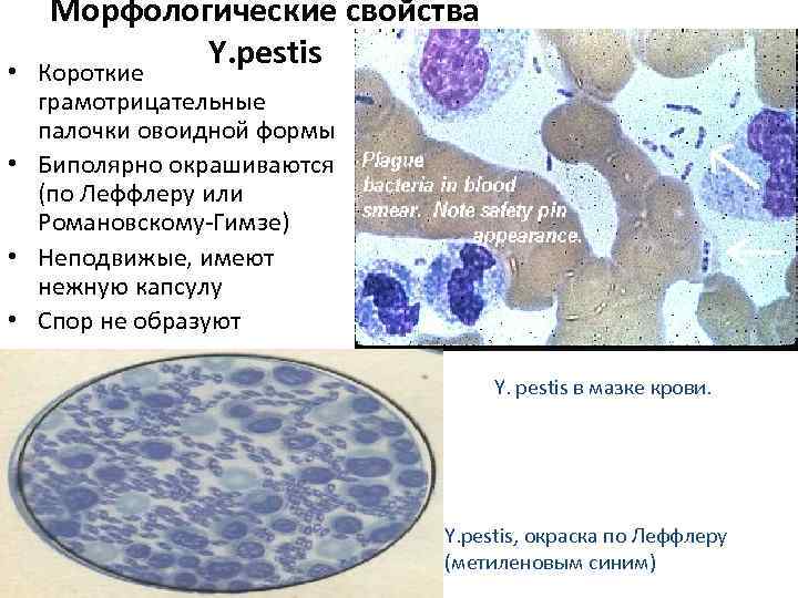 Окраска по романовскому гимзе мазок