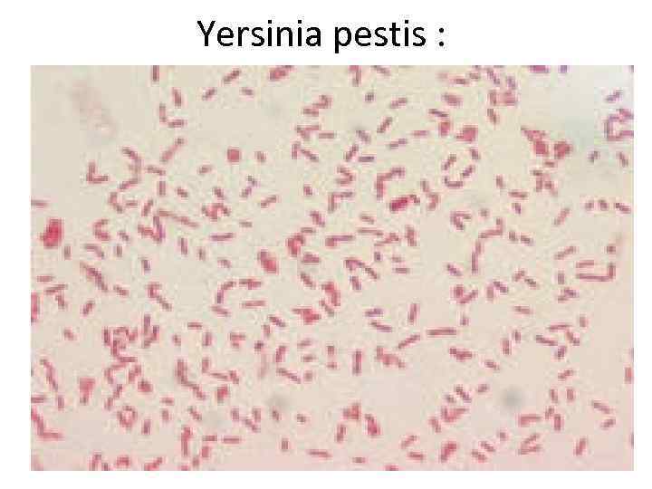 Yersinia pestis : . 