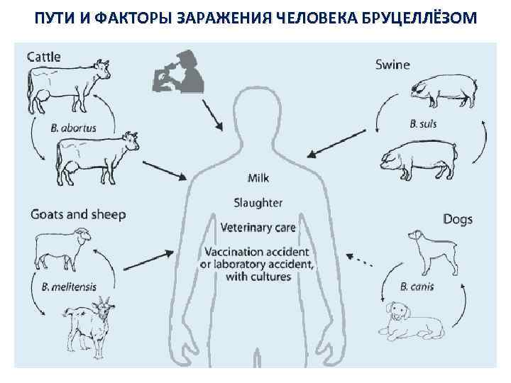 ПУТИ И ФАКТОРЫ ЗАРАЖЕНИЯ ЧЕЛОВЕКА БРУЦЕЛЛЁЗОМ 