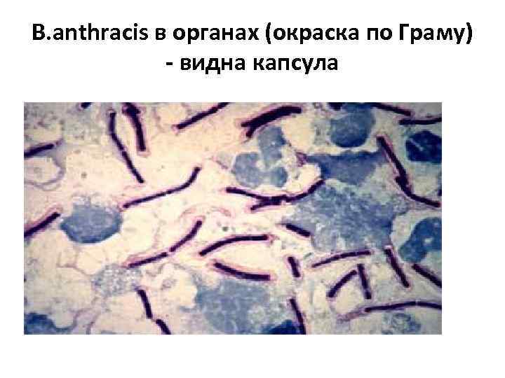 B. аnthracis в органах (окраска по Граму) - видна капсула 