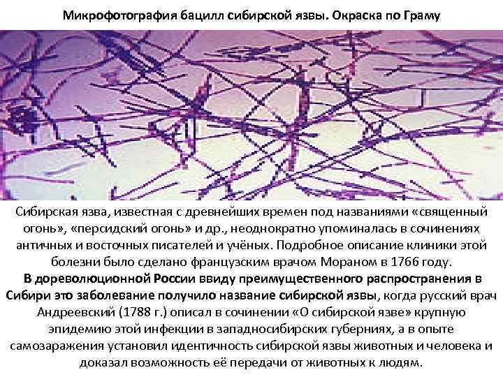 Микрофотография бацилл сибирской язвы. Окраска по Граму Сибирская язва, известная с древнейших времен под