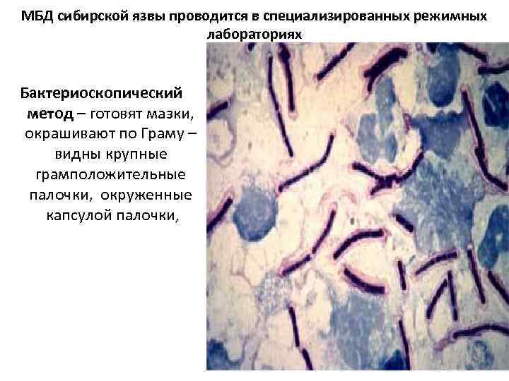 МБД сибирской язвы проводится в специализированных режимных лабораториях Бактериоскопический метод – готовят мазки, окрашивают