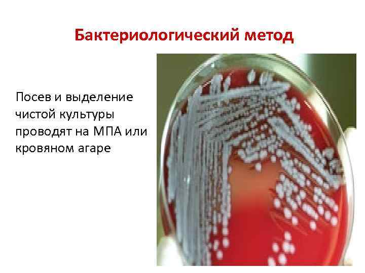 Бактериологический метод Посев и выделение чистой культуры проводят на МПА или кровяном агаре 