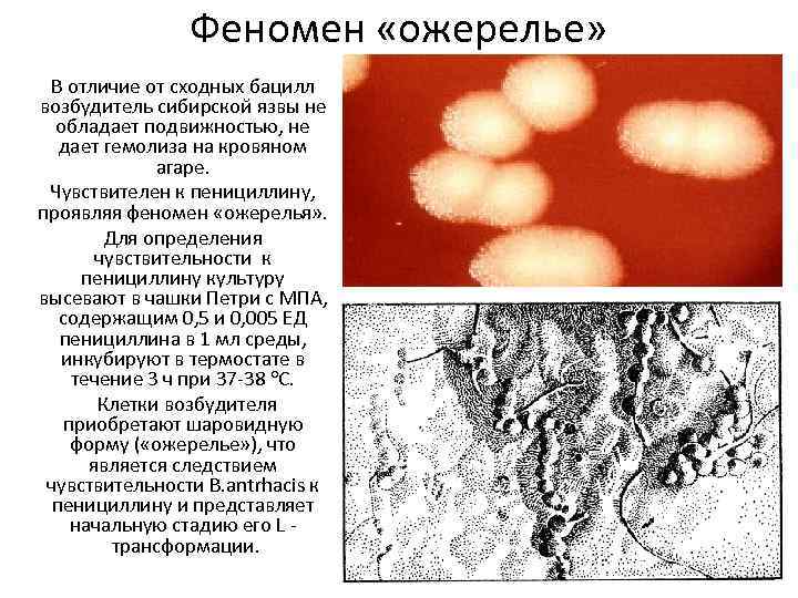 Феномен «ожерелье» В отличие от сходных бацилл возбудитель сибирской язвы не обладает подвижностью, не