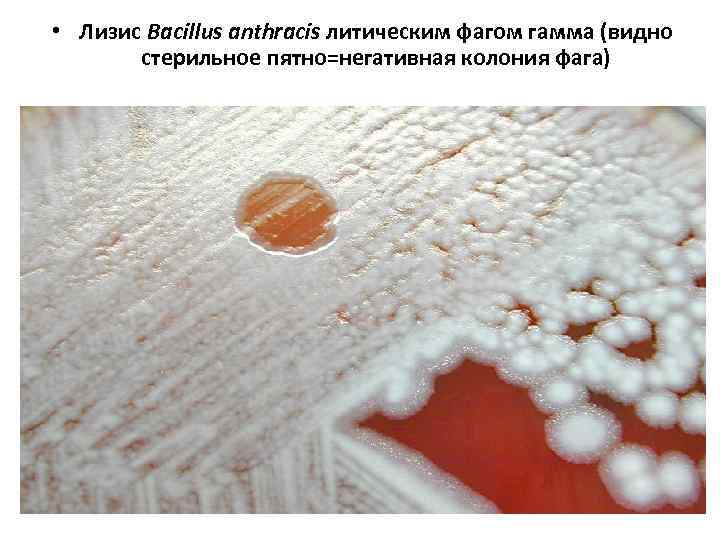 • Лизис Bacillus anthracis литическим фагом гамма (видно стерильное пятно=негативная колония фага) 