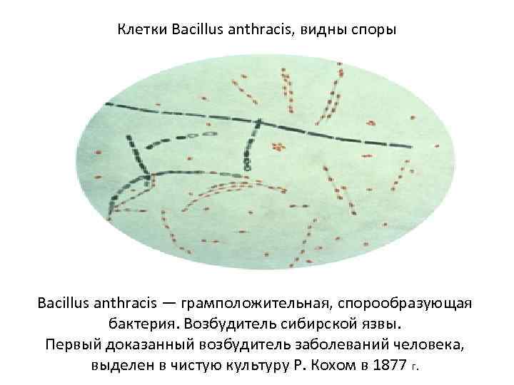 Клетки Bacillus anthracis, видны споры Bacillus anthracis — грамположительная, спорообразующая бактерия. Возбудитель сибирской язвы.