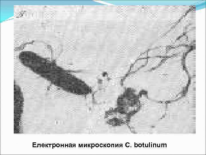 Електронная микроскопия C. botulinum 