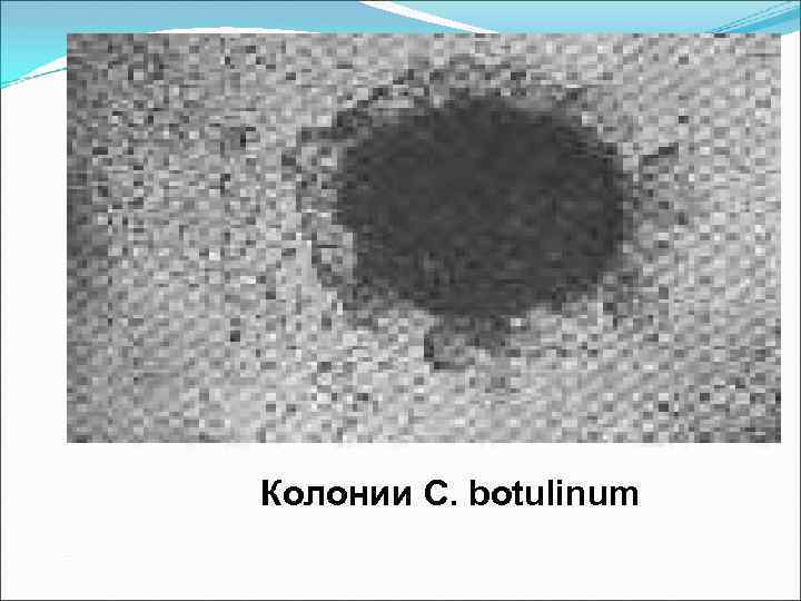 Колонии C. botulinum 