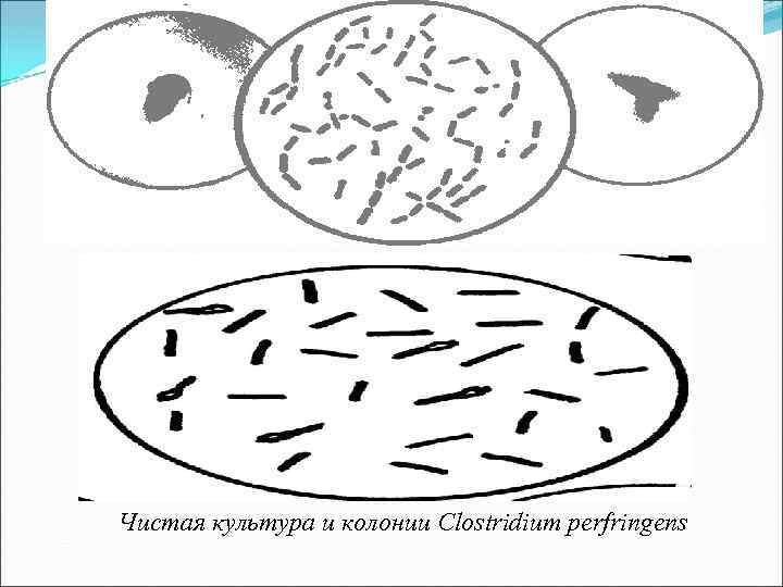 Чистая культура и колонии Clostridium perfringens 