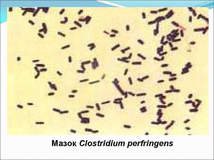 Мазок Clostridium perfringens 