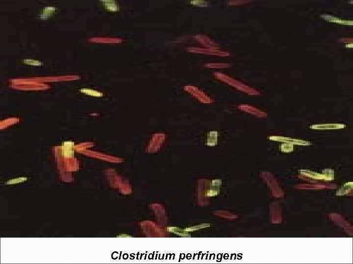 Clostridium perfringens 