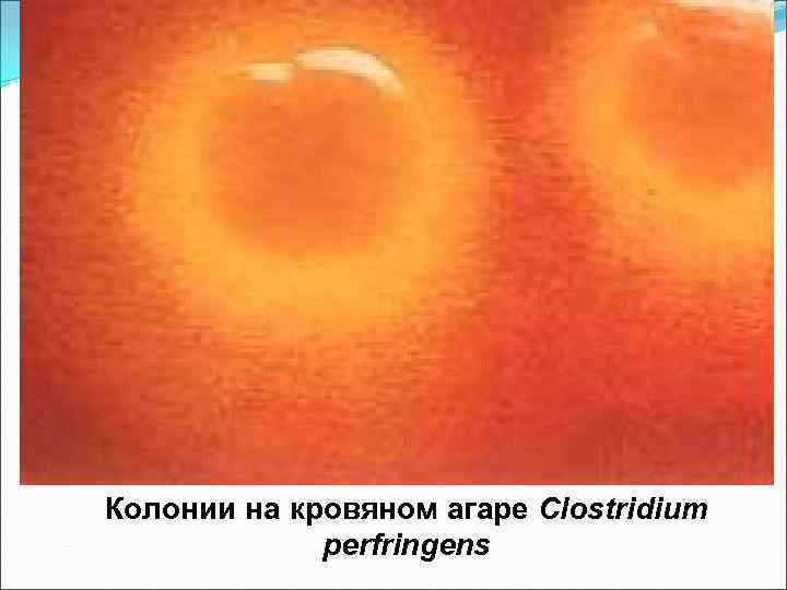 Колонии на кровяном агаре Clostridium perfringens 