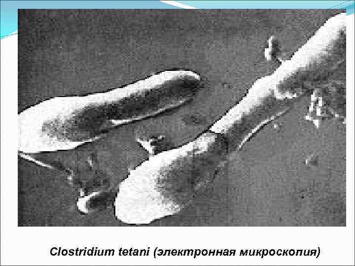 Clostridium tetani (электронная микроскопия) 