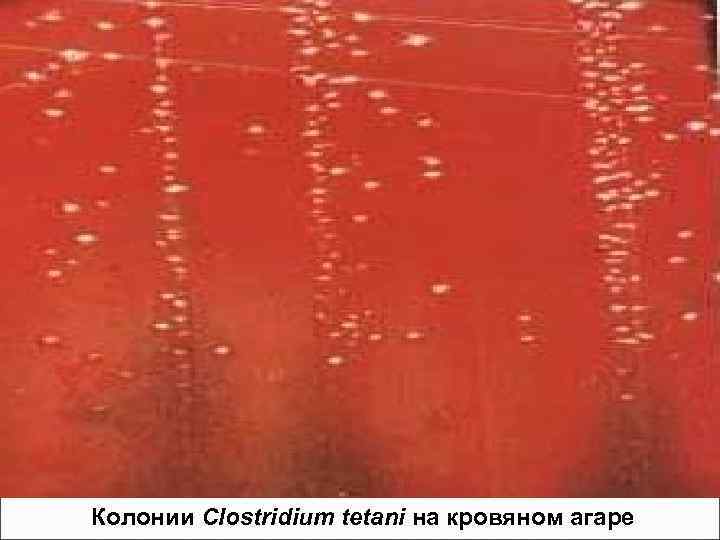 Колонии Clostridium tetani на кровяном агаре 