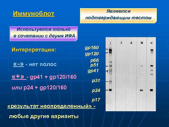 Иммуноблот Является подтверждающим тестом Используется только в сочетании с двумя ИФА Интерпретация: «-» -