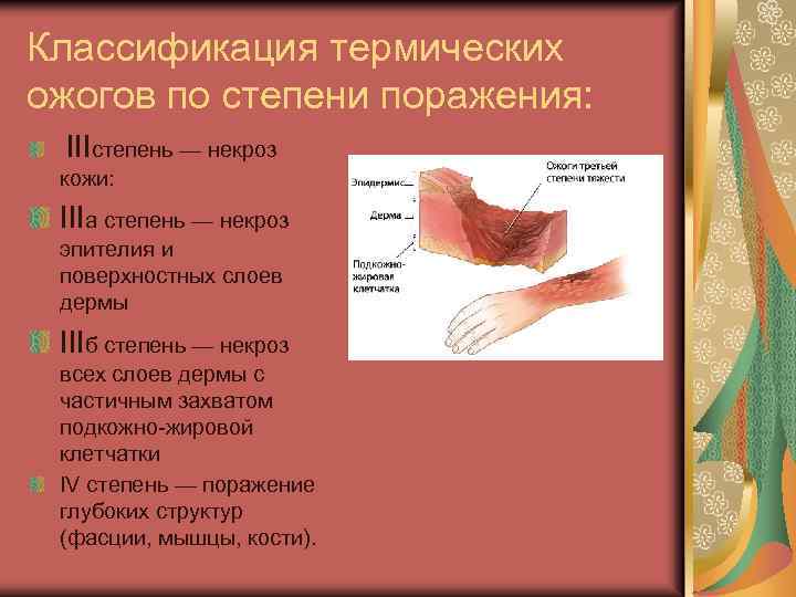 Классификация термических ожогов по степени поражения: IIIстепень — некроз кожи: IIIа степень — некроз