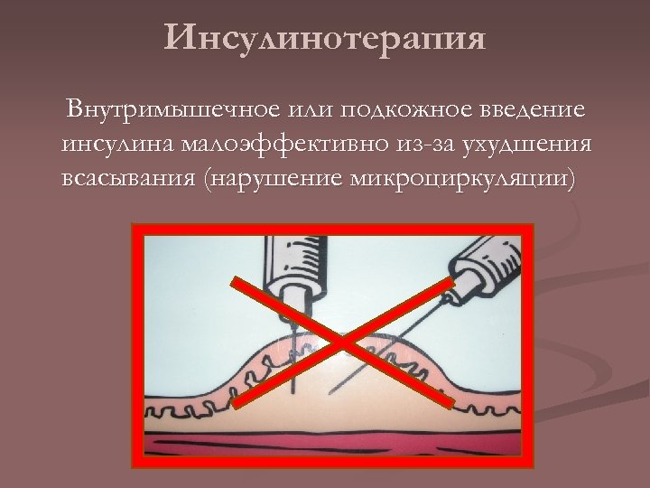 Инсулинотерапия Внутримышечное или подкожное введение инсулина малоэффективно из-за ухудшения всасывания (нарушение микроциркуляции) 