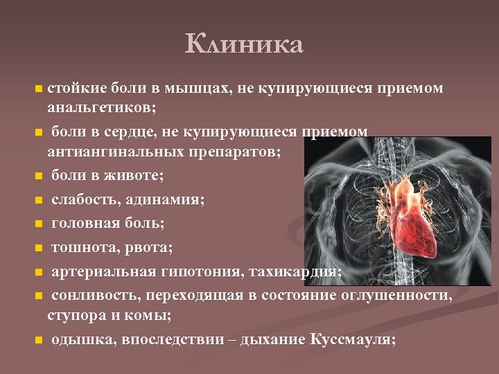 Клиника n стойкие боли в мышцах, не купирующиеся приемом анальгетиков; n боли в сердце,