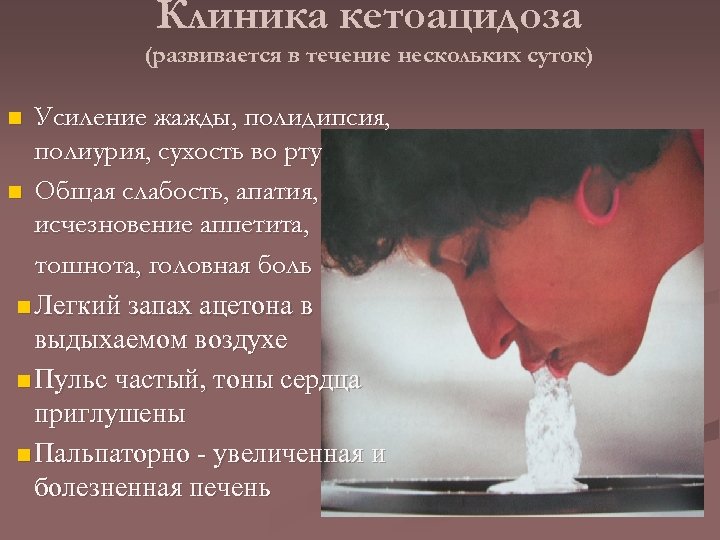 Клиника кетоацидоза (развивается в течение нескольких суток) Усиление жажды, полидипсия, полиурия, сухость во рту