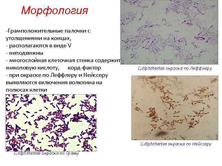 Морфология -Грамположительные палочки с утолщениями на концах, - располагаются в виде V - неподвижны