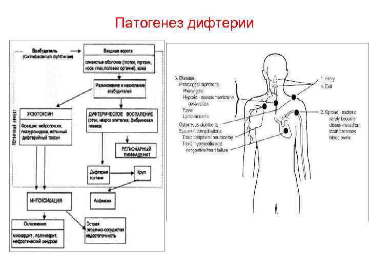 Патогенез дифтерии 