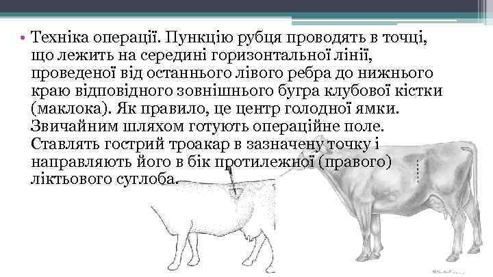  • Техніка операції. Пункцію рубця проводять в точці, що лежить на середині горизонтальної