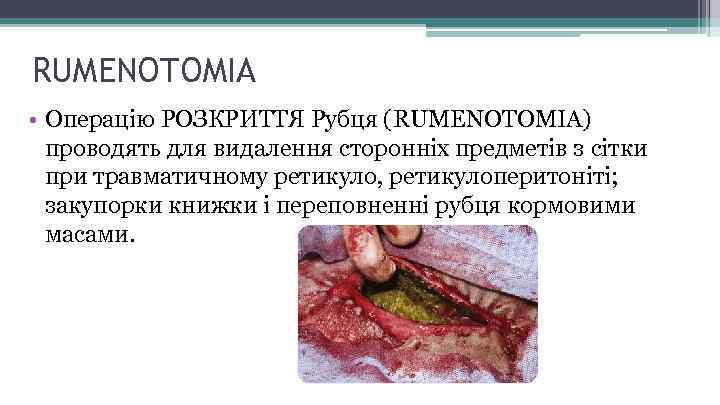 RUMENOTOMIA • Операцію РОЗКРИТТЯ Рубця (RUMENOTOMIA) проводять для видалення сторонніх предметів з сітки при